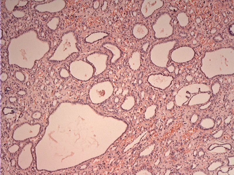 Path Image